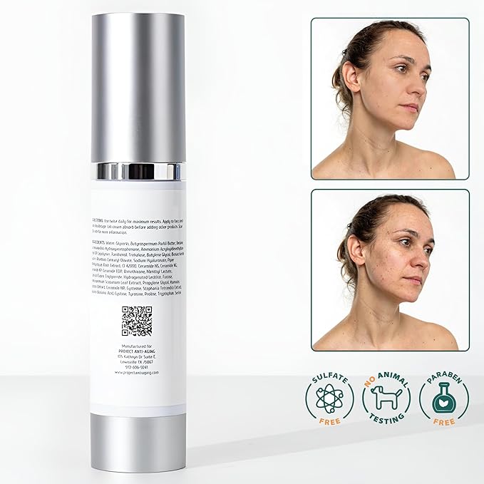Ceramide Moisturizer for Face – Barrier Repair Cream for Compromised, Dry, Sensitive Skin – Deep Hydration & Lipid Support – Hidratante Facial con Ceramidas