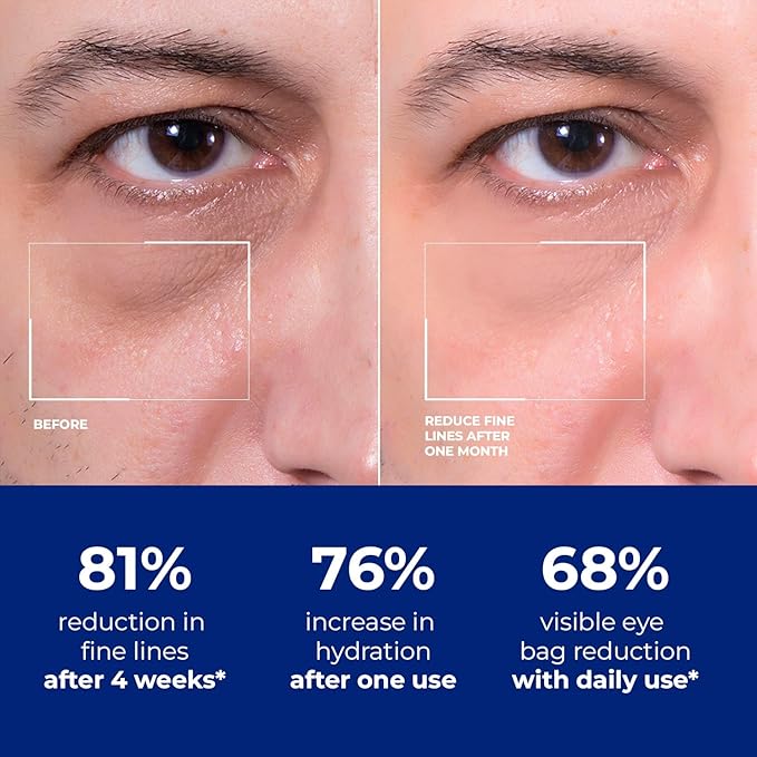 Mens Eye Bags Treatment Cream: Under Eye Repair for wrinkles Baggy Puffiness and Dark Circles - Anti-aging Hydrating with Peptides + Hyaluronic Acid + Niacinamide + Botanical complex+VC