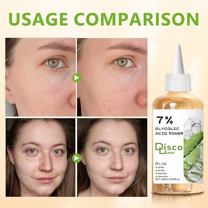 7% Glycolic Acid Exfoliating Toner, Hydrating Facial Toner, Smooth Glowing Skin, Even Skin Tone, Improve Skin Texture, Gentle Formula for Daily Use