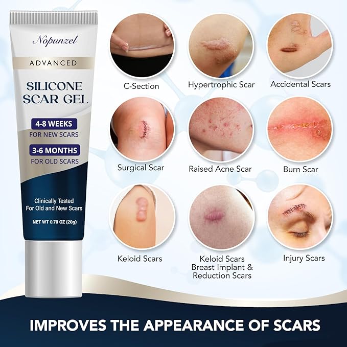 Silicone Scar Gel: Silicone Gel for Scars - Improve Scar Appearance for Old and New Scars - Medical Grade Silicone - Advanced Scar Gel - Scalds - Surgery - Injury - Stitches - Burns - 20g