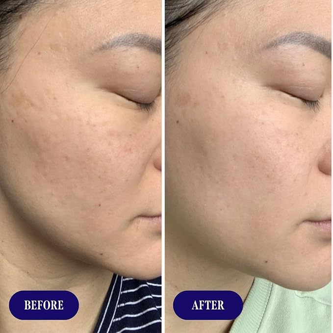 Three Ships - Jelly Drops Kakadu Plum + Mushroom Hyaluronic Acid Serum | Hydrate, Replenish, Plump Skin | Cruelty-Free, Vegan, Paraben-Free, Sensitive Skin Safe (1 fl oz | 30 mL)