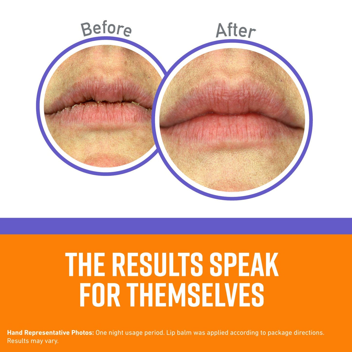 O'Keeffe's Lip Repair Night Treatment Lip Balm for Dry, Cracked Lips - 0.25 Ounce Jar (1 Pack) - Moisturizer Extremely Cracked, Dry Lips