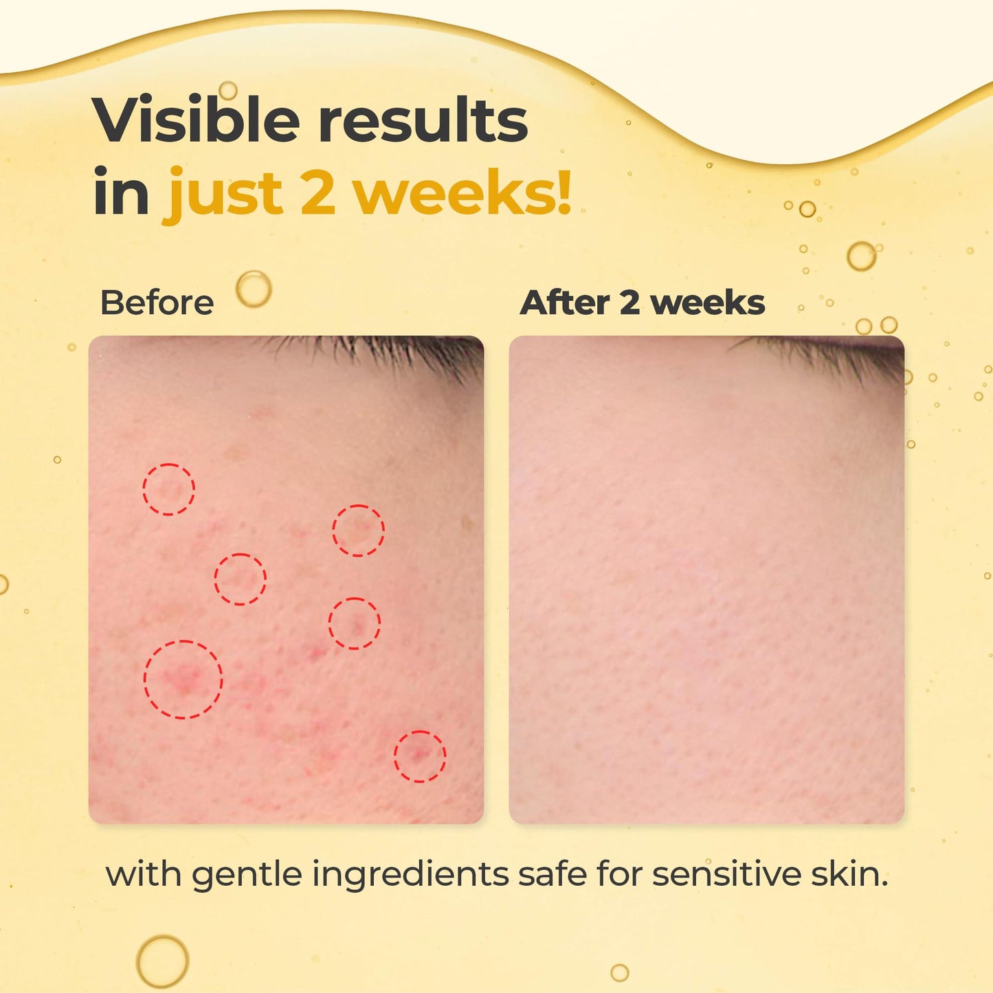 HEEDA Glutathione Even & Glow Serum, Niacinamide, Turmeric, Tranexamic Acid, Glass, Radiant, Balanced & Healthy-Looking Skin, Korean Skincare