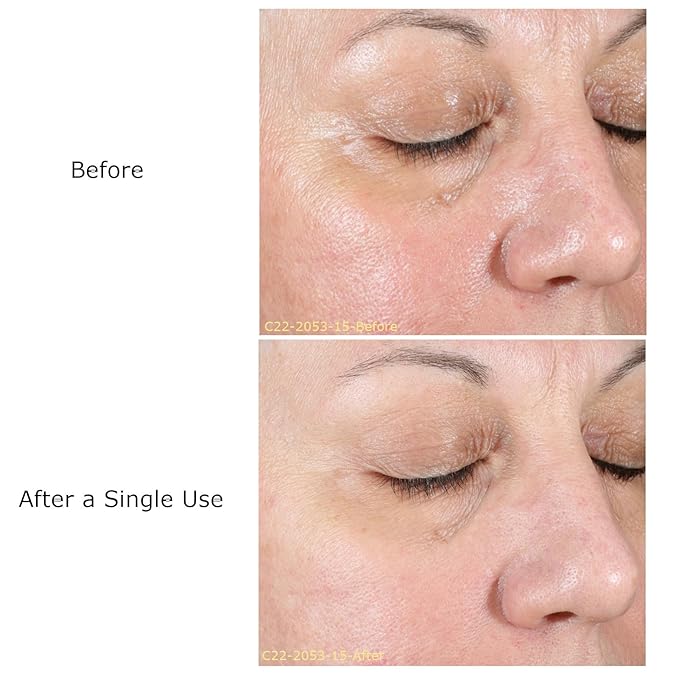 Daily Moisturizing Collection, Activator with Hydrating