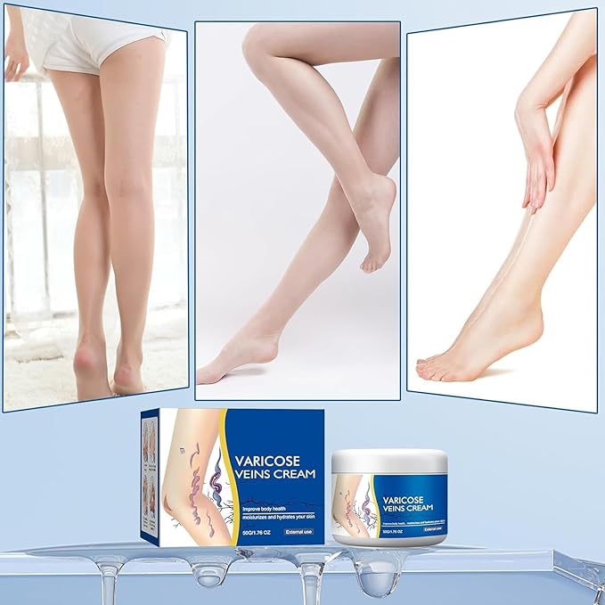 1PCS Varicose Leg Repair Cream, Skin Cream for Legs 50g/1.76fl.oz