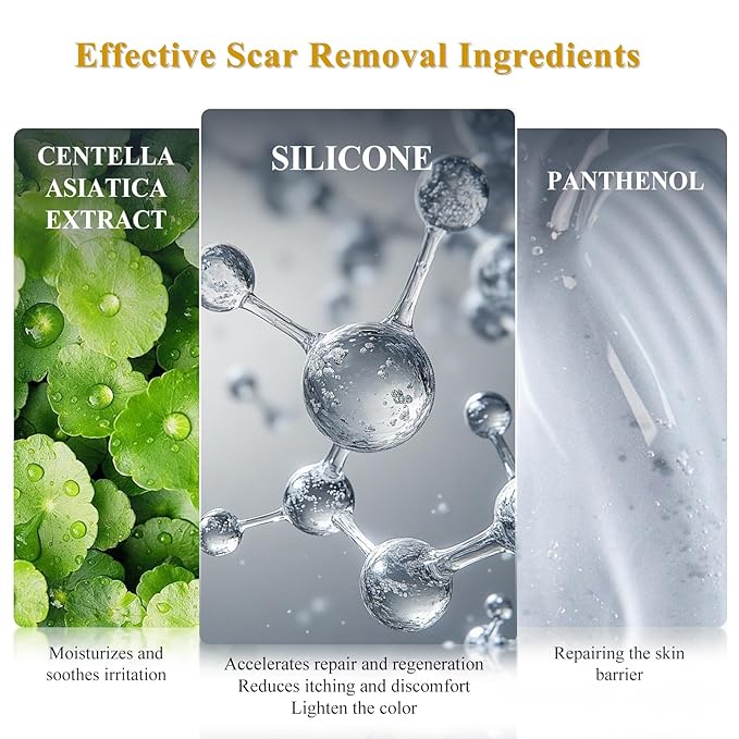 Silicone Scar Cream Scar Gel, Advanced Scar Cream for Surgical Scars, C-Section, Injury, Stretch Marks, Acne, Burns, Keloids, Old & New Scars, 1.85 Oz (55g)