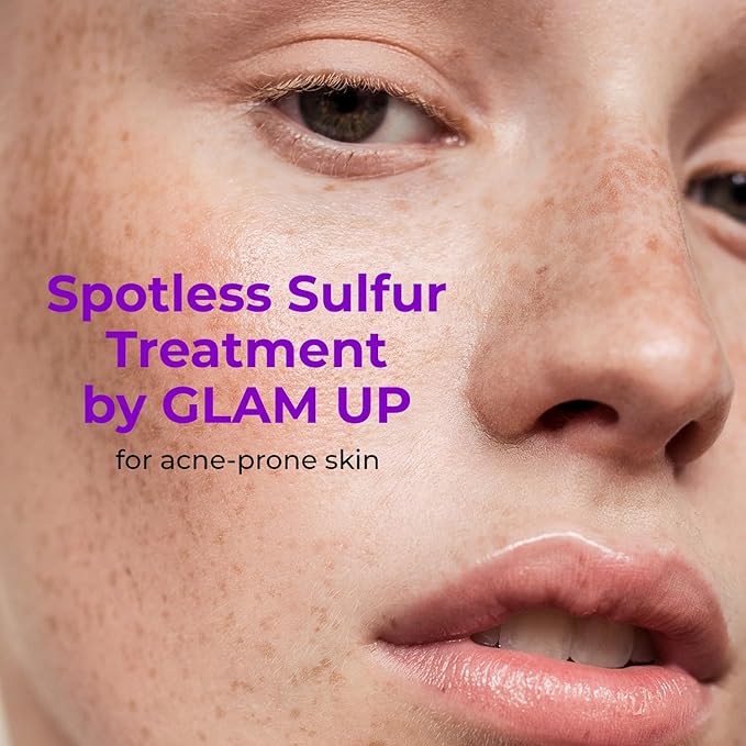 GLAM UP Spotless 10% Sulfur Treatment Spot Serum for Fast Healing Pimples, Blemishes and Acne Breakouts, Overnight Acne Soothing15mL, 0.5 fl. oz. [Made in the US]