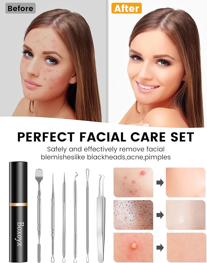 Pimple Popper Tool Kit - Boxoyx 6 Pcs Pore Prep Blackhead Remover Comedone Extractor Kit with Box for Quick and Easy Removal of Pimples, Blackheads, Zit Removing, Forehead,Facial and Nose (Silver)