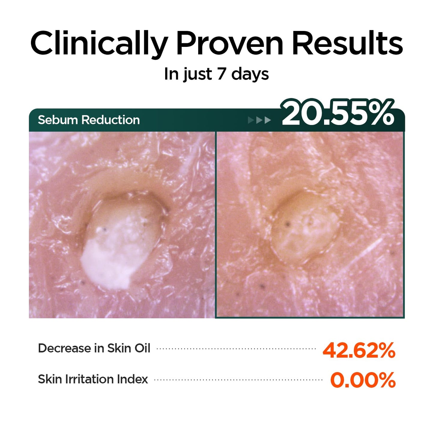 P.CALM Barrier Cycle Daily Sheet Mask – 30-Day Sheets with Papaya Extract & Allantoin for Sebum Care & Moisturizing, Korean Skincare (350g / 12.35 oz)