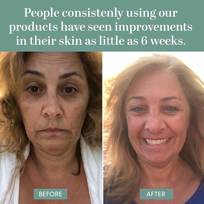 Ceramide and Peptide ageless Cream, Daily Facial Repair Moisturizing Cream, Skincare, Moisturizer, Safe for Sensitive Skin, Vegan, Gluten-Free