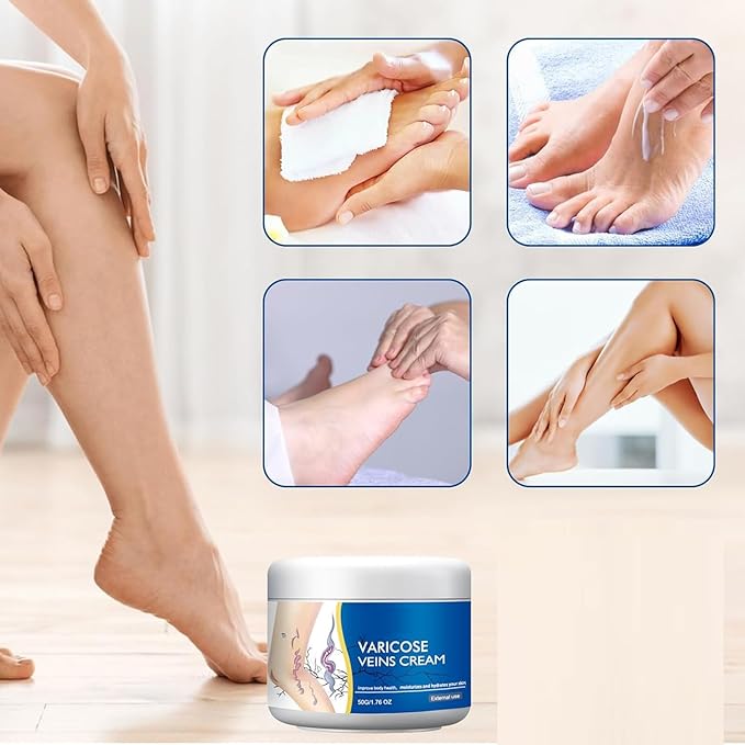 1PCS Varicose Leg Repair Cream, Skin Cream for Legs 50g/1.76fl.oz