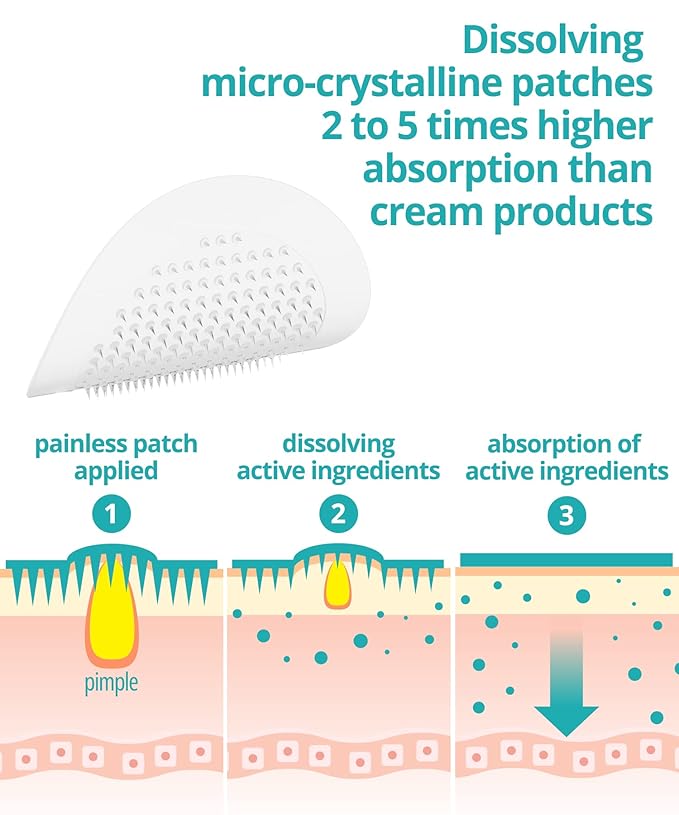 Dissolving Microdart Acne Patch for Deep Blemish - 18 Patches - Fast Acting Microdart Pimple Patches for face - Hyaluronic Acid, Tea Tree Zit patches for face - Hydrocolloid Bandages