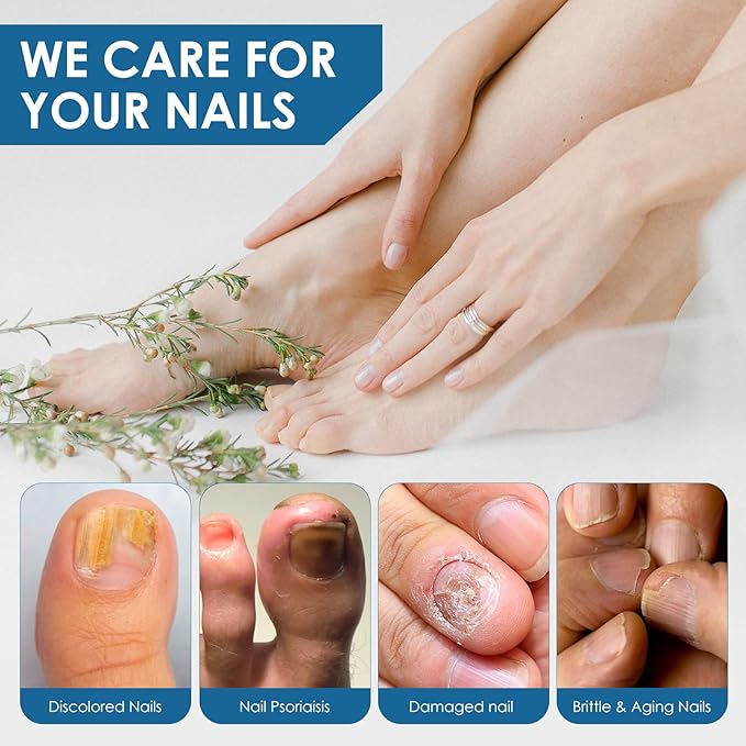Toenail Repair Treatment, Extra Strength Nail