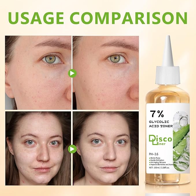 7% Glycolic Acid Exfoliating Toner, Hydrating Facial Toner, Smooth Glowing Skin, Even Skin Tone, Improve Skin Texture, Gentle Formula for Daily Use