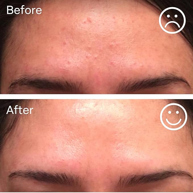 nuorganic Hyaluronic Acid + B5 + Plant Stem Cells: Skin Feels Hydrated, Plumper, Dewy and Rejuvenated - PhytoCellular Science + Multi Molecular + 100 Hour Hydration + Better Skin in 7 Days