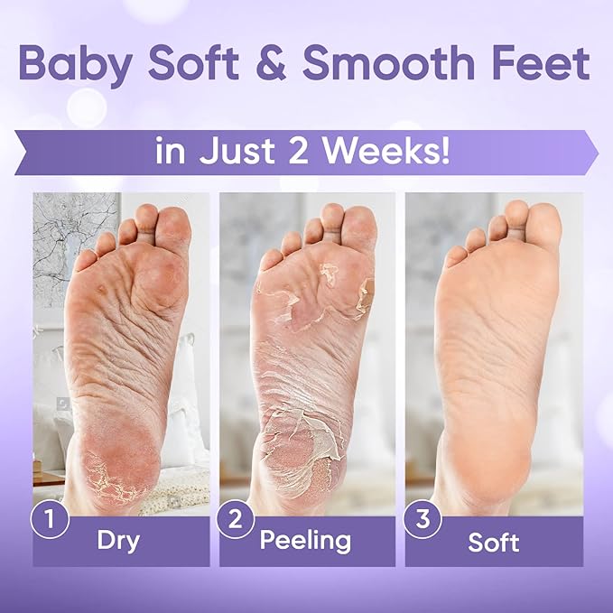 Foot Peel Mask - Foot Mask for Baby Soft Skin - Remove Dead Skin, Dry, Cracked Feet & Callus, Foot Spa, Made with Aloe Vera Extract for Women and Men (5 Pairs Lavender)