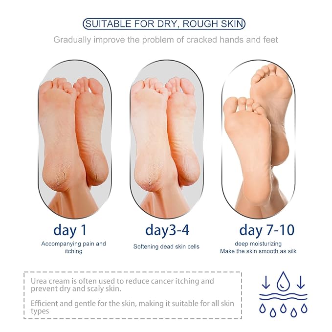 Soelegant Urea Cream, Urea Foot and Hand Cream for Dry, Cracked, Callus and Dead Skin, Moisture Stick for Foot Care, Cracked Heel Treatment, Knees, Elbows, Hands, Repair,