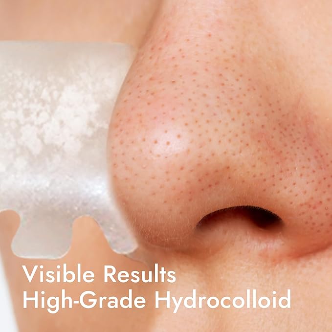 Epielle Over-Zit Nose Patches | Ultimate Hydrocolloid Solution for Clear Skin | 10 Acne Pimple and Blemish Patches for Nose