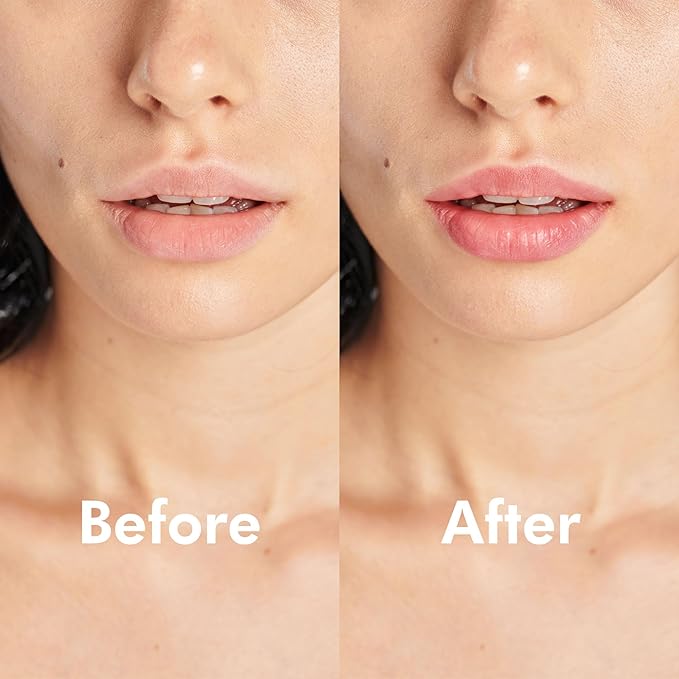 PURSONIC Lip Mask Overnight for Ultimate Blossom