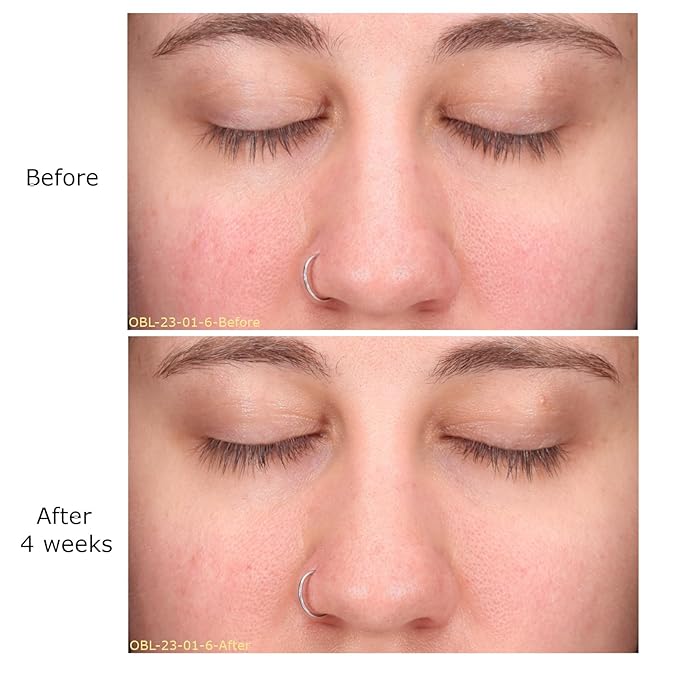 Decongest & Clarify System Collection, Activator