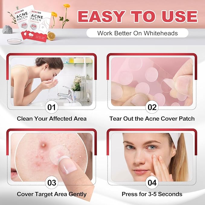 216 Counts Pimple Patches for Face, Hydrocolloid Acne Patches Zit Patches for Face Acne Spot Treatment Patch Cystic Acne Treatment Stickers Blemish Hydrocolloid Cover for all Skin Type