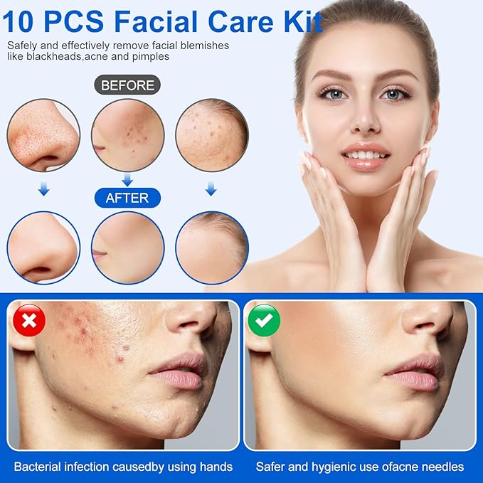 Pimple Popper Tool Kit,10 Pcs Professional Blackhead Remover Comedones Extractor for Easy Removal for Pimples,Blackheads,Zit Removing, Facial and Nose, Acne Removal Kit with Metal Box (Silver)