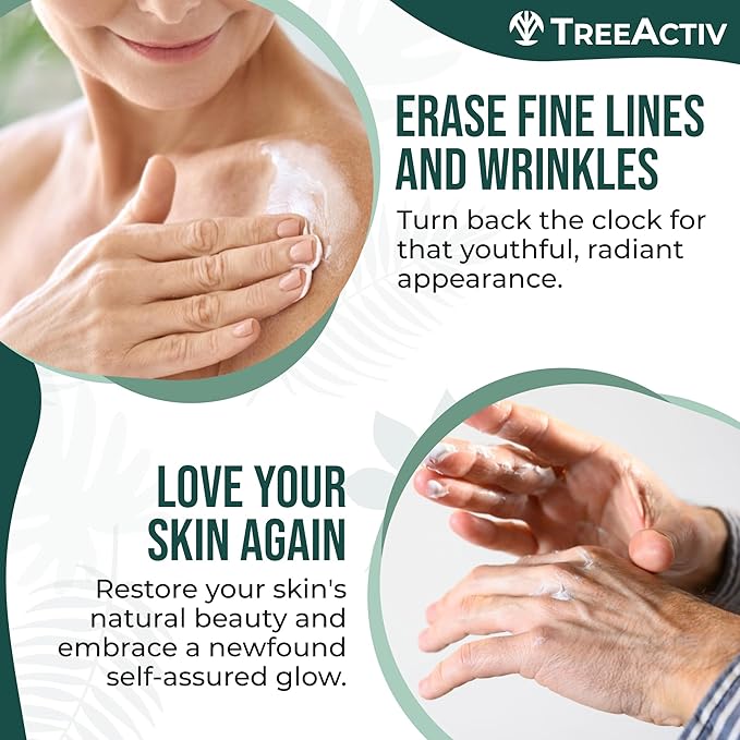 TreeActiv Crepey Skin Repair Treatment Original Formula, 8 fl oz, Firming Cream For Face & Neck, Skin Firming Lotion with Hyaluronic Acid, Crepey Treatment to Address Dry Crepe