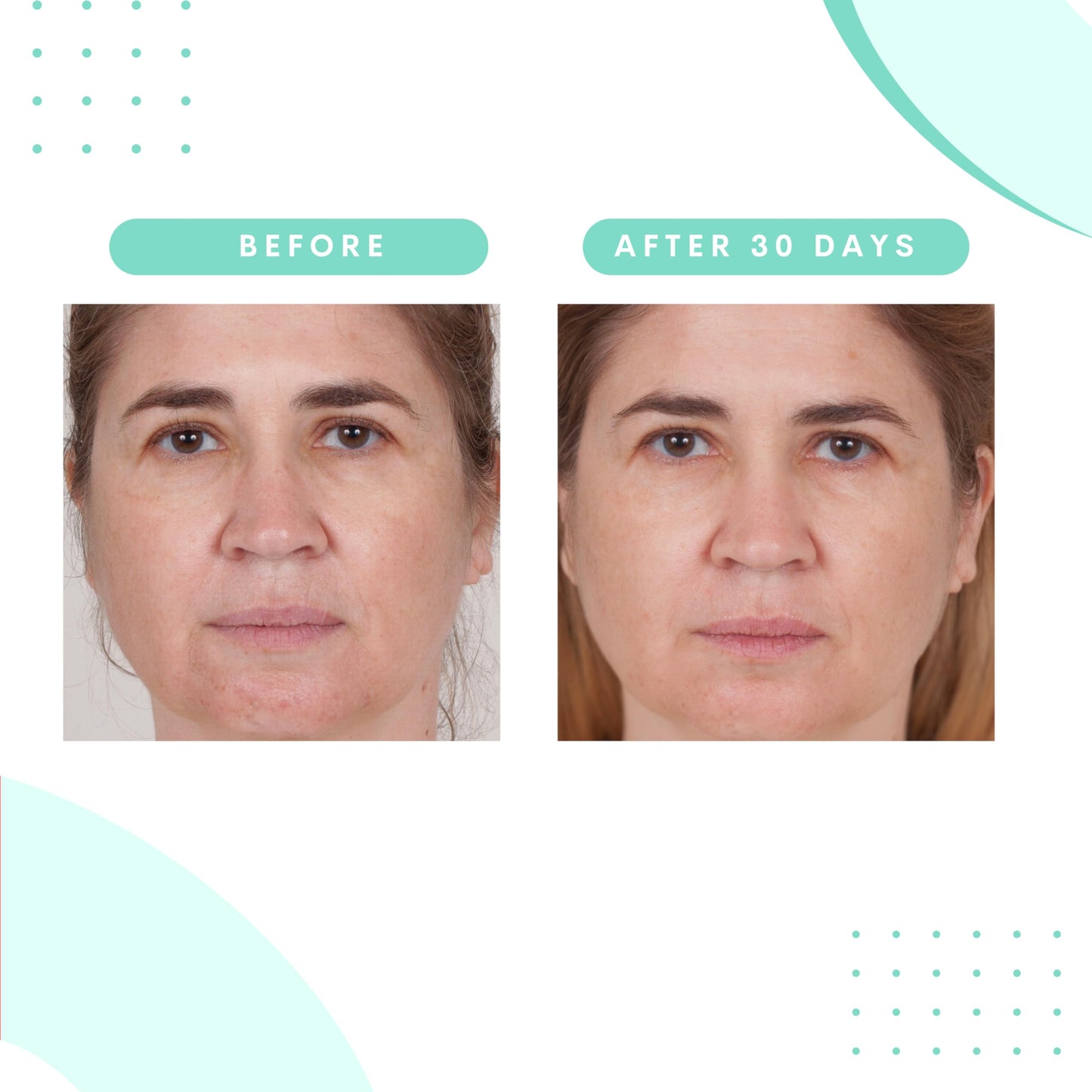 Serious Skincare Glycolic Skin Renewal Set - Retexturizing Serum - Facial Moisture Cream - Face Wash Cleanser - Balancing Blue Tansy Extract - Improve Appearance of Lines, Wrinkles and Enlarged Pores