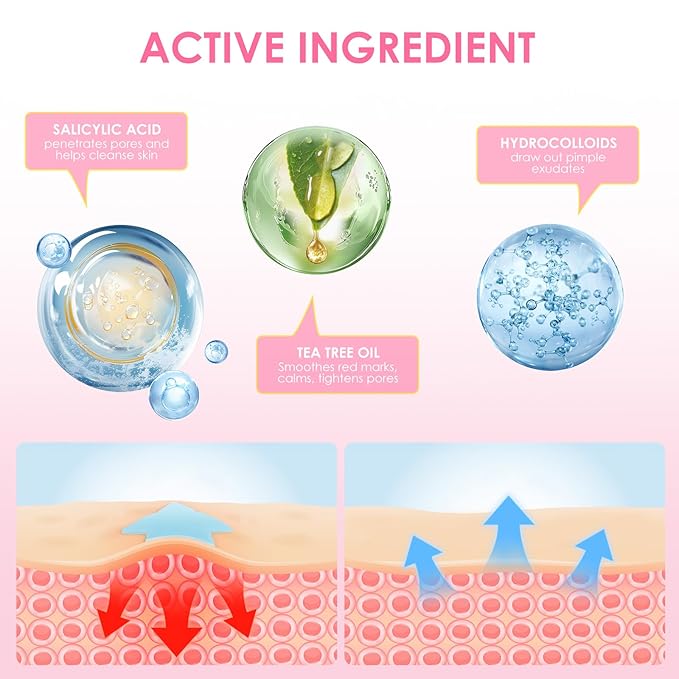 AUSLKA Star Pimple Patches (360 Pcs) Cute Zit Patches for Face, Star Spot Stickers with Salicylic Acid, Hydrocolloid Pimple Patches Absorb Fluid Quickly, Star Blemish Patches for Skin Care, Vegan