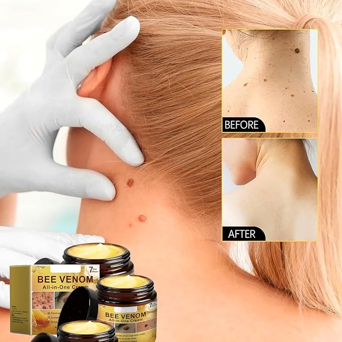 Gaukomzs 2-Pack Bee Venom Cream, New Professional Bee Venom Repair Cream, Natural Skin Moisturizer For All Skin Types