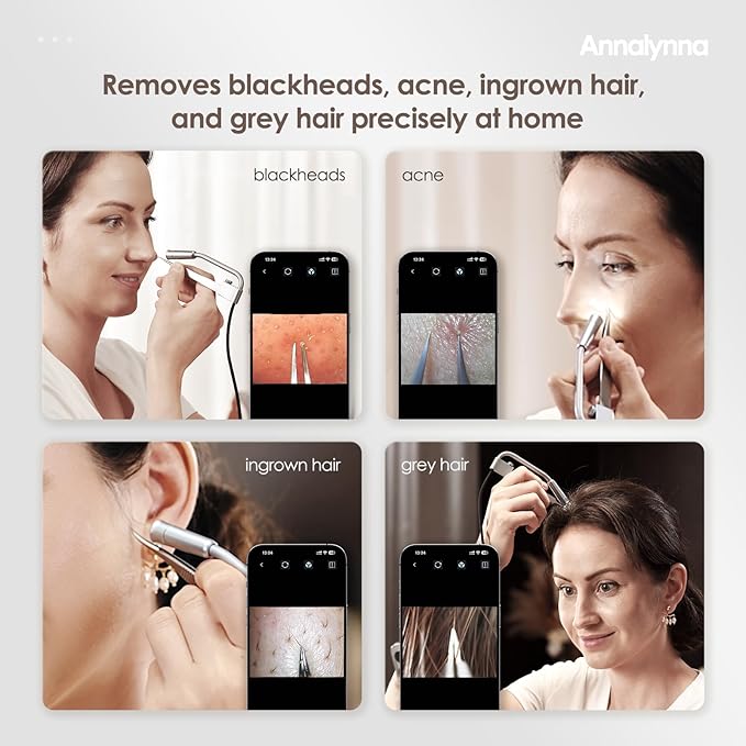 Luma 1 Visual Blackhead Remover Tweezers with Camera - Pimple Popper Tool with Camera 20x Magnification, 1080P, 8 LED Lights, with 2* Alloy Steel Tweezers and Blackhead & Pimple Popper Tool Kit (6ps)