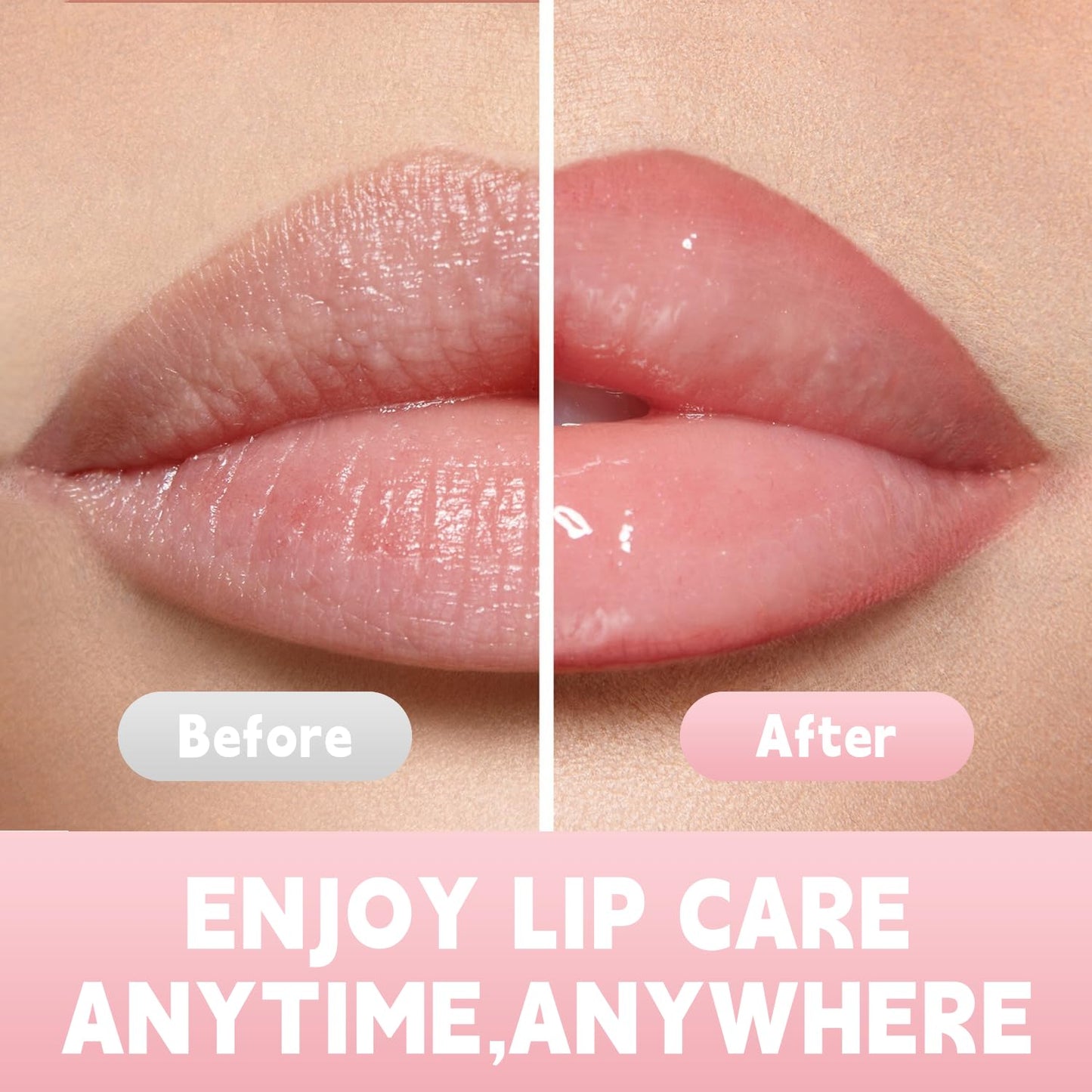 HOOJLX Anti Wrinkle Patches for Lips, Smoothing Smile Line & Lip Area Wrinkles, 6 Patches Skin-friendly Lip Lift Wrinkle Remover Patches