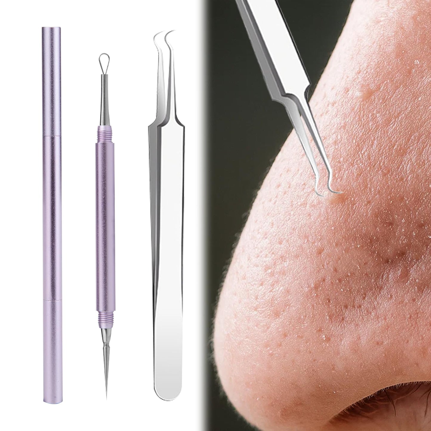 Nouiseuns Blackhead Tool Set for Face, Purple Stainless Steel Acne Extractor and Whitehead Extractor Tool – 2Pcs Professional Pimple Remover Kit with Angled Tweezers & Loop Needle for Nose & Skin Care
