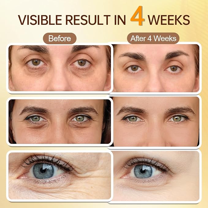 5% Caffeine & Retinal Eye Serum Roller - Undereye Dark Circle Treatment, Puffiness & Wrinkle Reduction, Gel-Based Formula Eye Cream, 0.51 fl oz
