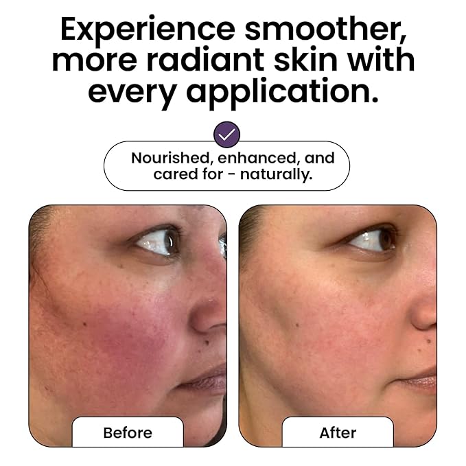 Cattle Creek Tallow Face Moisturizer - Whipped Beef Tallow for Face with Sweet Almond, Myrrh, Frankincense & Rose Oils – Grass-Fed Beef Tallow for Face Care, Hydration & Sensitive Skin (4oz)