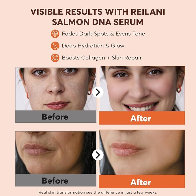 PDRN Serum - Skin Care Solution with Salmon DNA, Hyaluronic Acid, Tripeptide 1, Vitamins - 10000ppm Ultra Hydrating Serum for Facial Blemishes, Fine Lines, Collagen & Elastin Production