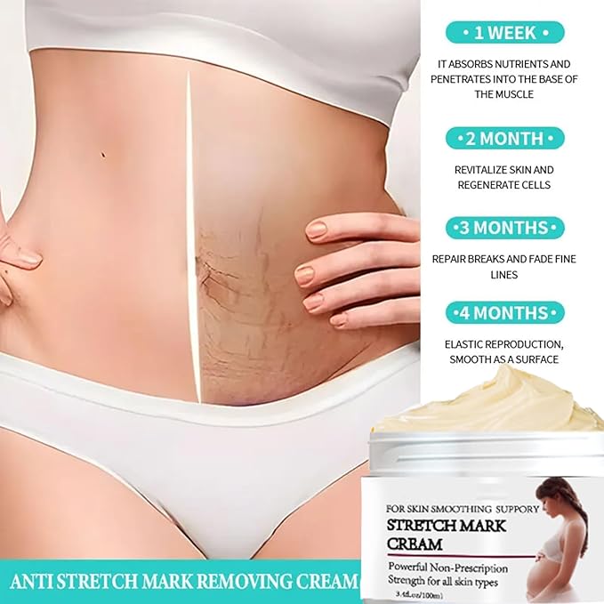 Stretch Mark Prevention Cream for Pregnancy,