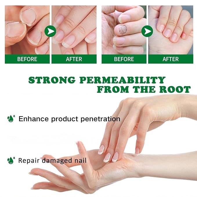 Ginger Nail Treatment, Nail Treatment,