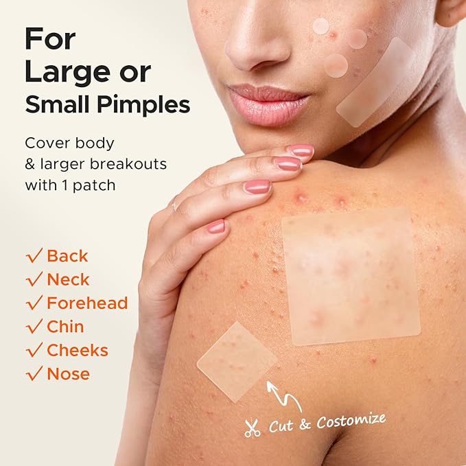 TKTK Large Pimple Patches, 60 mm XL Acne Patches, Big Hydrocolloid Bandages for Body, Face, Forhead, Chin, Neck Zit Breakouts, Hydrocolloid Patch (Square, Strip, Dot 5 Sizes 265 Count)