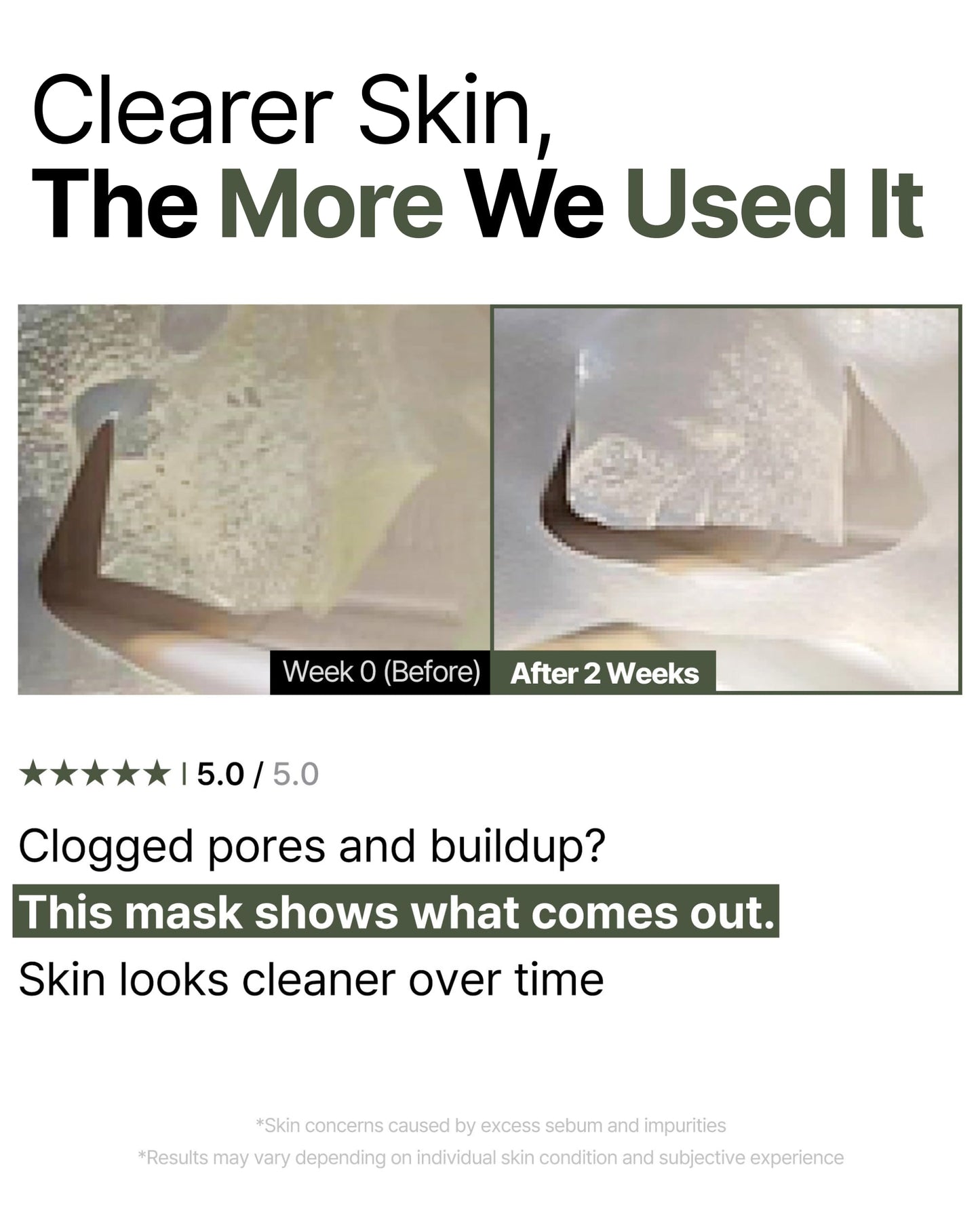 EIOM Trouble Patch Mask | Korean Face Mask – Hydrating & Acne Face Mask for Blemish-Prone Skin, Calming Skincare & Oil Control Sheets (20ml x 4)