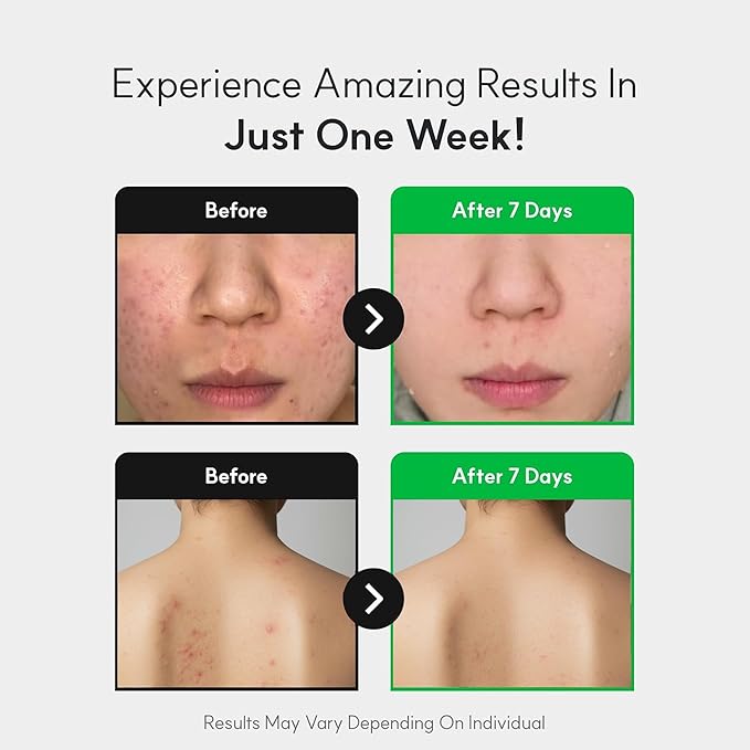 Spicule CICA Foam Cleanser, 3.38 fl oz/100ml | Hydrating Korean Face Wash with Centella Asiatica, Hyaluronic Acid & Tea Tree, Gentle Daily Cleanser for Sensitive & Acne-Prone Skin