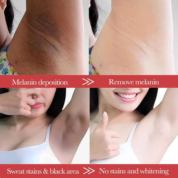 Sakura Skin Wh-ite-ning Cream Women Moisturizing - Da-rk Sp-ot Corrector Underarm Cream - Sk in Ble-aching Cream for Body Armpit Wh-ite-ning - Women Skin Lig-hte-n ing cream with Hyaluronic & Collagen