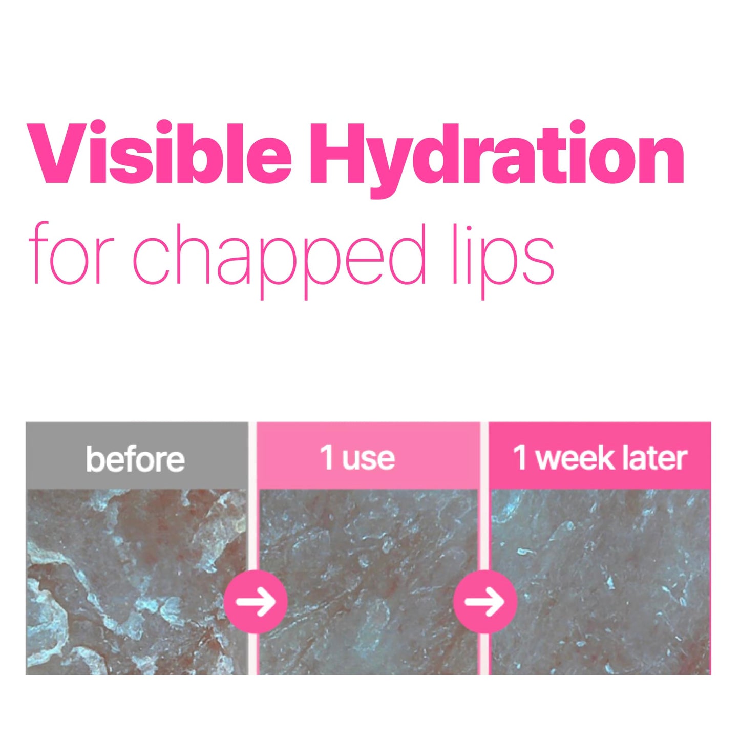 ISOI Refresh Lip Sleeping Mask, Overnight Hydrating Lip Treatment with 4X Ceramide & Botanical Oils, Korean Lip Care (0.88 oz, 25g)