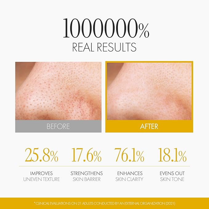 Chaga Mushroom Biome Smoothing Ampoule | Skin-Nourishing Face Serum for Glowing Skin |Skin-Repairing Korean Serum for Smoother Skin Texture| Strengthening Night Repair Serum (1.69 Fl Oz)