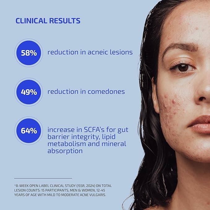 Shaant Clear Skin Supplement – 60 Vegan Capsules | Acne Probiotics with 9-Strain Blend, Green Tea EGCG & Guggul – Daily Support for Acne-Prone Skin & Clear Complexion