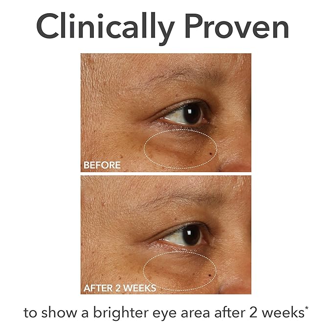 Dr Dennis Gross DermInfusions Fill + Repair Eye Cream: Hydrating & Brightening Treatment for Dark Circles, Fine Lines & Wrinkles, Firms & Smooths 360° Eye Area, 0.5 Oz