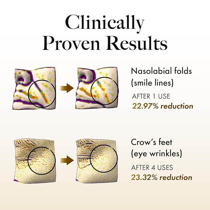 MASTINA Mastic Serum Roller - Dark Circle Remover & Eye Serum for Brighter, Firmer Under Eyes, Korean Skin Care, 0.5 fl oz,White Mastic Complex 63% + Tranexamic Acid 2% + Niacinamide 5%