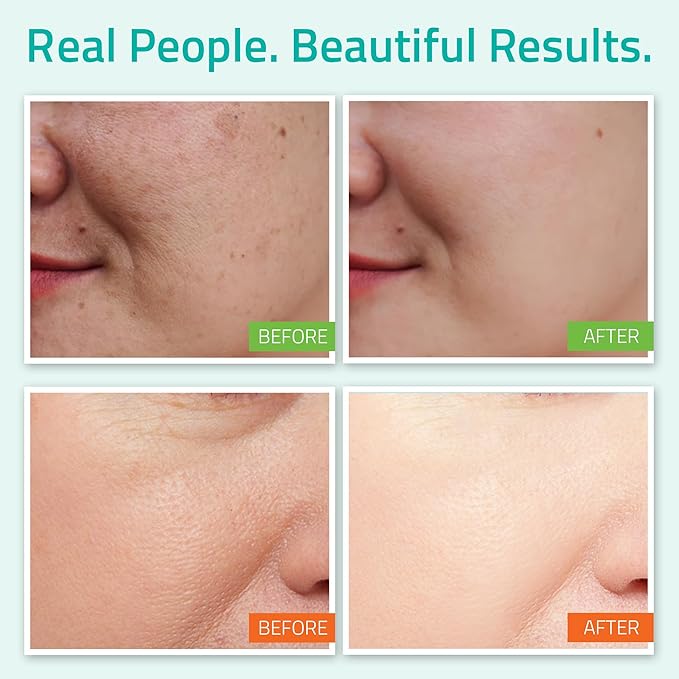 YEOUTH Hyaluronic Acid Serum with Vitamin