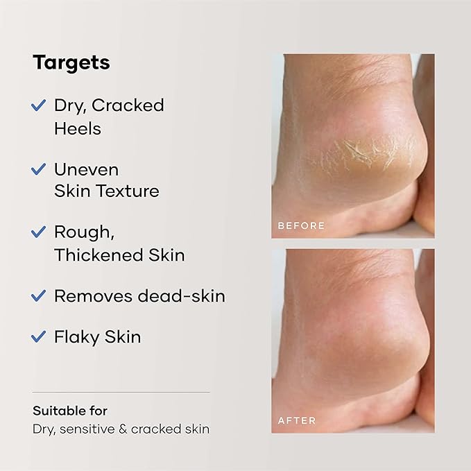 Foot Care Cream for Cracked Heels | Repairs, Softens, and Exfoliates | Foot Cream for Women and Men, 50 g (Pack of 1)