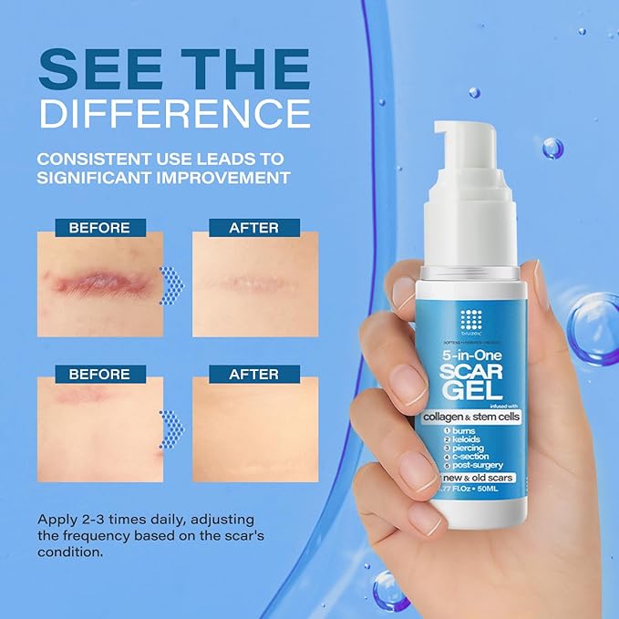 5-in-1 Scar Cream for Surgical Scars: Advance Silicone Scar Gel with Collagen and Stem Cells, Keloid Scar Treatment, Scars Removal of New and Old Scars, Piercing, Burns, C-section, After Surgery, 50g